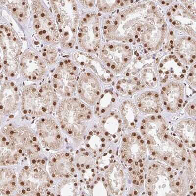Immunohistochemistry-Paraffin: GLTSCR1 Antibody [NBP2-30603]