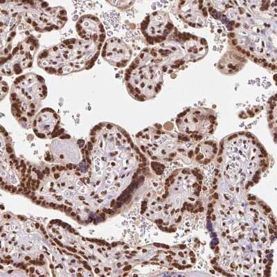 Immunohistochemistry-Paraffin: GLTSCR1 Antibody [NBP2-30603]