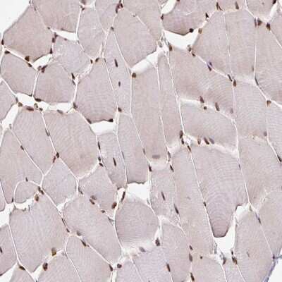 Immunohistochemistry-Paraffin: GLTSCR1 Antibody [NBP2-30603]