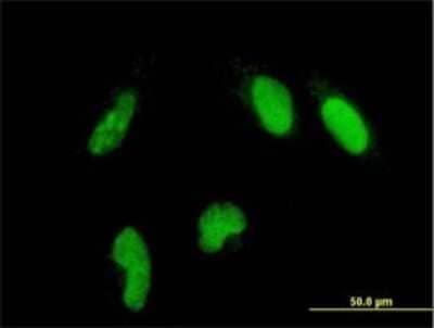 Immunocytochemistry/ Immunofluorescence: GLTSCR2 Antibody (5A8) [H00029997-M03]