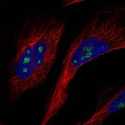 Immunocytochemistry/ Immunofluorescence: GLTSCR2 Antibody [NBP2-56742]