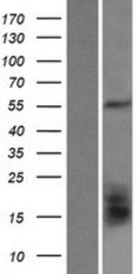 Western Blot: Glutamate Dehydrogenase 2/GLUD2 Overexpression Lysate [NBP2-07493]