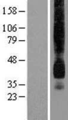 Western Blot: Glut1 Overexpression Lysate [NBP2-10406]