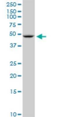 Western Blot: GLUT10 Antibody (1E12) [H00081031-M02]