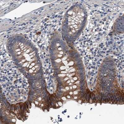 Immunohistochemistry-Paraffin: GLUT10 Antibody [NBP2-13326]