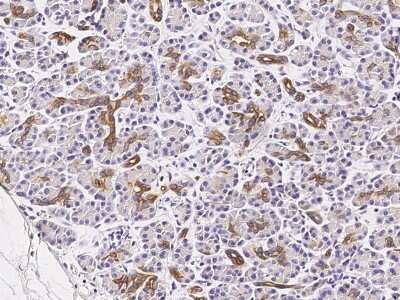 Immunohistochemistry-Paraffin: GLUT10 Antibody [NBP2-98748]