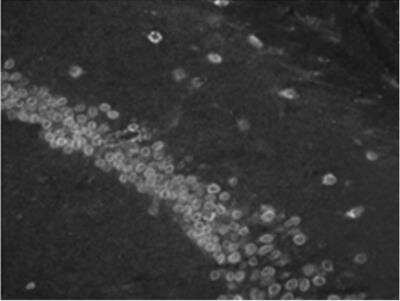 Immunohistochemistry-Paraffin: GLUT10 Antibody [NBP3-12262]