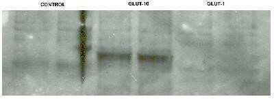 Western Blot: GLUT10 AntibodyBSA Free [NB100-490]