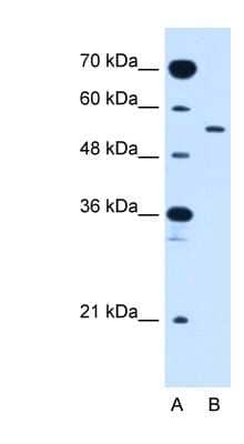 Western Blot: GLUT10 Antibody [NBP1-59688]