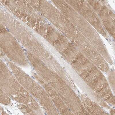 Immunohistochemistry-Paraffin: GLUT12 Antibody [NBP1-91944]