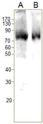 Western Blot: GLUT12 Antibody [NBP3-12263]