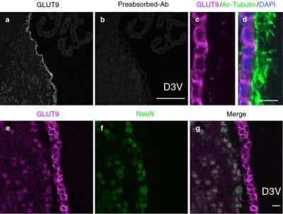 Immunohistochemistry: GLUT9 Antibody - BSA Free [NBP1-05054]