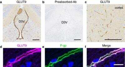 Immunohistochemistry: GLUT9 Antibody - BSA Free [NBP1-05054]