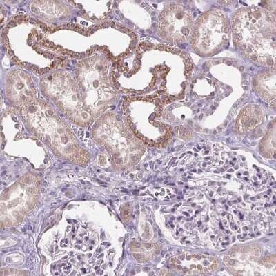Immunohistochemistry: GLUT9 Antibody [NBP2-47448]