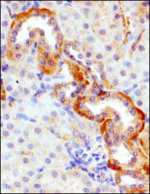 Immunohistochemistry-Paraffin: GLUT9 Antibody [NBP1-06271]