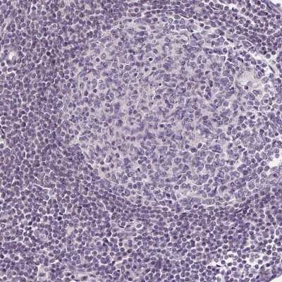 Immunohistochemistry-Paraffin: GLUT9 Antibody [NBP2-47448]