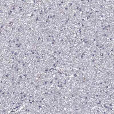 Immunohistochemistry-Paraffin: GLUT9 Antibody [NBP3-16970]