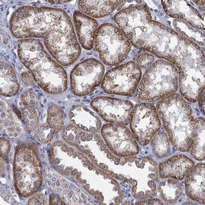 Immunohistochemistry-Paraffin: GLUT9 Antibody [NBP3-16970]