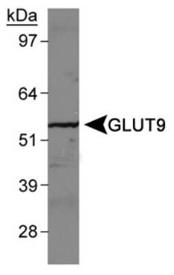 Western Blot: GLUT9 AntibodyBSA Free [NBP1-05054]