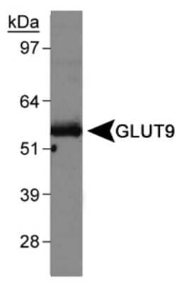 Western Blot: GLUT9 Antibody [NBP1-06271]