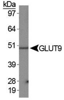 Western Blot: GLUT9 Antibody [NBP1-06565]