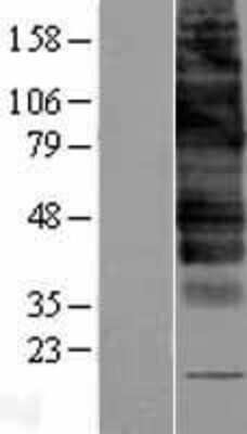 Western Blot: GLUT9 Overexpression Lysate [NBP2-04185]