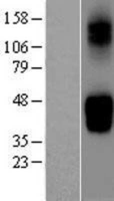 Western Blot: GLUT9 Overexpression Lysate [NBP2-04377]