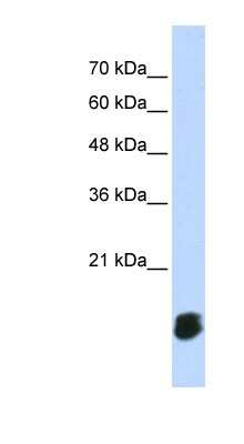 Western Blot: GLXR5 Antibody [NBP1-57645]