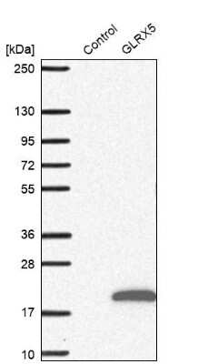 Western Blot: GLXR5 Antibody [NBP1-89897]