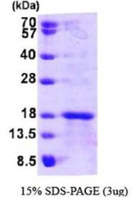 SDS-PAGE: Recombinant Human GLXR5 His Protein [NBP1-44471]