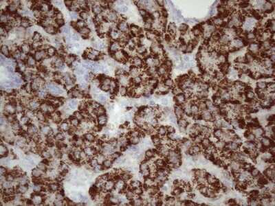 Immunohistochemistry: GLYAT Antibody (OTI4D1) [NBP2-45897]