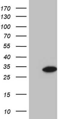 Western Blot: GLYAT Antibody (OTI4D1) [NBP2-45897]