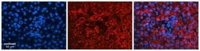 Immunohistochemistry: GLYAT Antibody [NBP1-54714]