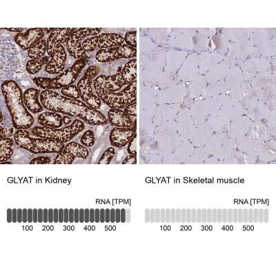 Immunohistochemistry-Paraffin: GLYAT Antibody [NBP2-55298]