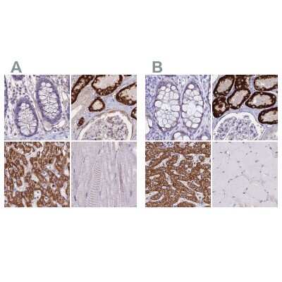 Immunohistochemistry-Paraffin: GLYAT Antibody [NBP2-55298]