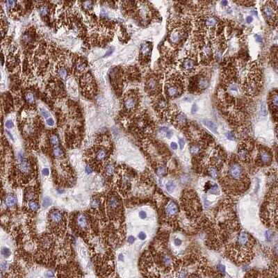 Immunohistochemistry-Paraffin: GLYAT Antibody [NBP2-55298]