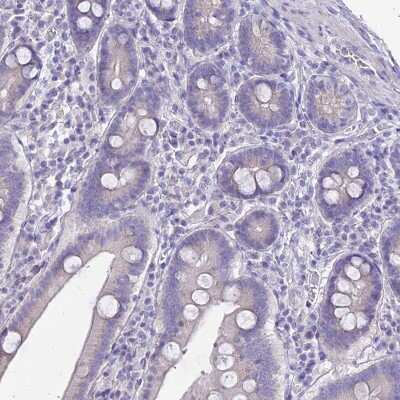 Immunohistochemistry-Paraffin: GLYAT Antibody [NBP2-58917]
