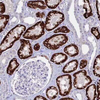 Immunohistochemistry-Paraffin: GLYAT Antibody [NBP2-58917]