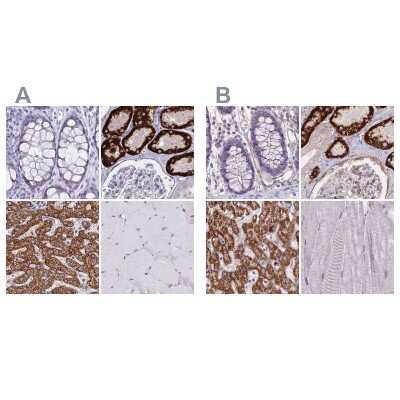 Immunohistochemistry-Paraffin: GLYAT Antibody [NBP2-58917]