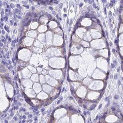 Immunohistochemistry-Paraffin: GLYAT Antibody [NBP2-58917]