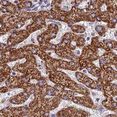 Immunohistochemistry-Paraffin: GLYAT Antibody [NBP2-58917]
