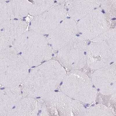Immunohistochemistry-Paraffin: GLYAT Antibody [NBP2-58917]