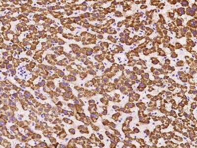 Immunohistochemistry-Paraffin: GLYAT Antibody [NBP2-99587]