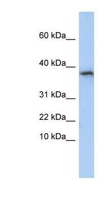 Western Blot: GLYAT Antibody [NBP1-54714]