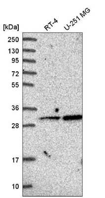 Western Blot: GLYAT Antibody [NBP2-55298]