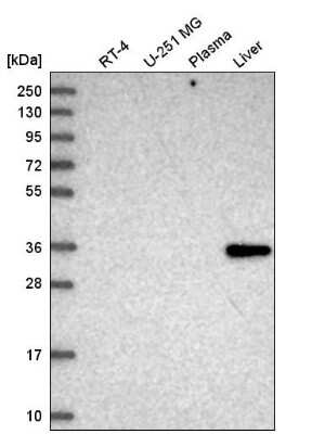 Western Blot: GLYAT Antibody [NBP2-58917]