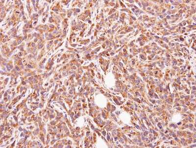 Immunohistochemistry-Paraffin: GLYATL1 Antibody [NBP1-32600]