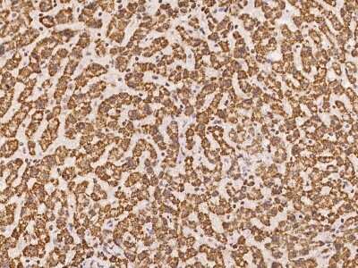 Immunohistochemistry-Paraffin: GLYATL1 Antibody [NBP2-98175]