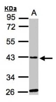 Western Blot: GLYATL1 Antibody [NBP1-32600]