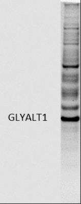 Western Blot: GLYATL1 Antibody [NBP1-32600]